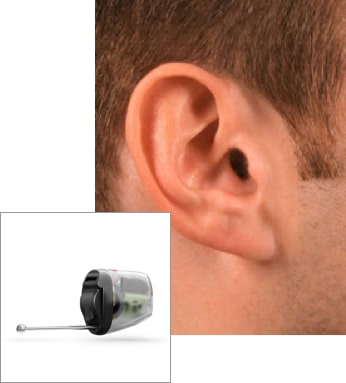 iic hearing aid